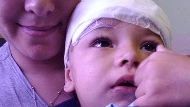 A un bebé sanjuanino se le cayó un basurero encima y terminó grave