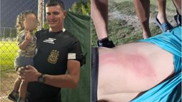 Habló el árbitro brutalmente agredido en la Liga Universitaria: Me pegaron por adicionar tiempo, no sé qué se les pasó por la cabeza Habló el árbitro brutalmente agredido en la Liga Universitaria: Me pegaron por adicionar tiempo, no sé qué se les pasó por la cabeza