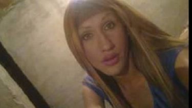 Trabajan para evitar la letal silicona industrial en los trans