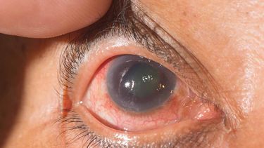 Foto: fuente Google.