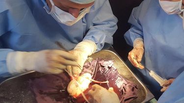 Un juez sanjuanino autorizó una donación de riñón entre dos amigos