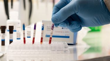 El Ministerio de Salud de La Rioja informó sobre el caso del sanjuanino con coronavirus: se desdijo