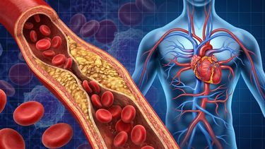 Un estudio vincula factores cardiovasculares con mayor riesgo de cáncer