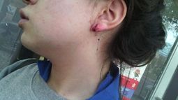 Tras la brutal pelea entre alumnas, los padres de una decidieron cortar de raíz