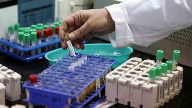 El nivel de testosterona puede decir mucho de cómo afectará el Covid-19 en un paciente masculino