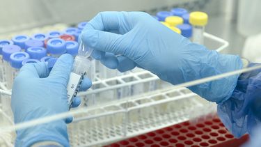 Ya detectaron 22 casos de viruela del mono en el país.