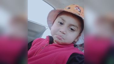 Así está Isaías, el nene que fue atacado por un pitbull en Caucete.