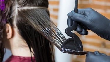 Sanjuanina casi quedó ciega después de un alisado en el pelo: Ruego sanarme