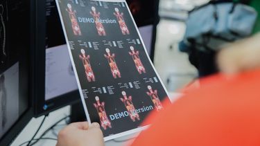 CEMEC: a 3 meses de inaugurado el supertomógrafo, cómo va la atención