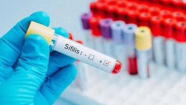 El trabajo de hormiga que realizan en el Ministerio de Salud para tener datos reales de sífilis en San Juan