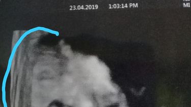 Una sanjuanina dice que apareció la imagen de Jesucristo en una eco