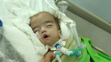 Otra mamá que no puede operar a su hijo por las vueltas de la obra social