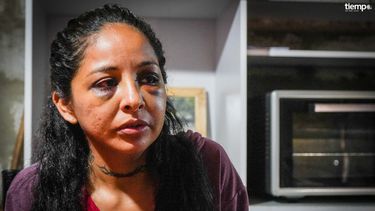 Sin botón antipánico, sin ventanas y con sus hermanos que la cuidan por turno: así vive Verónica, la sanjuanina que sobrevivió a la brutal paliza de su pareja