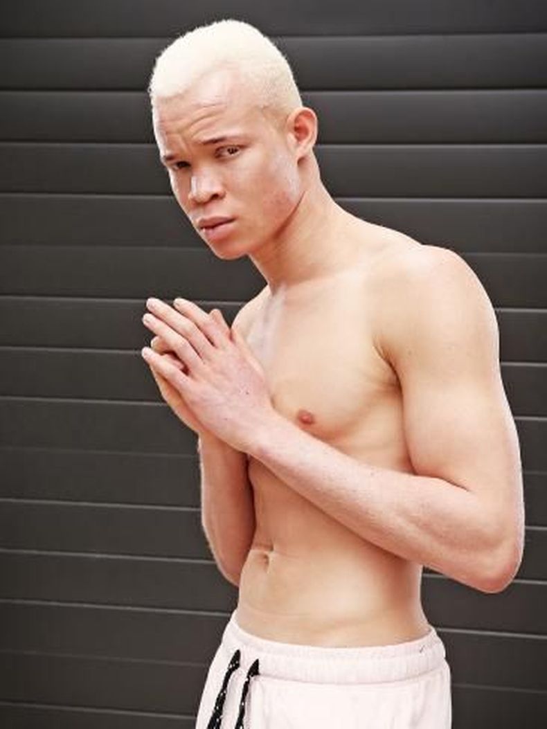 modelo albino africano