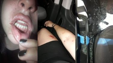 Una joven denunció que la golpearon y le robaron en el estacionamiento de un conocido boliche sanjuanino