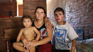 La lucha del joven con piel de cristal tuvo final feliz