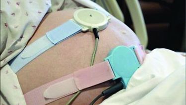 Las mujeres embarazadas en riesgo ya cuentan con un monitor fetal