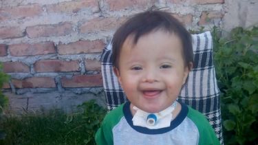 Mateo necesita una operación en sus cuerdas vocales y su familia pide ayuda