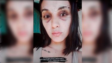 La víctima del cantante de Labriegos habla por primera vez: Me encerró en el baño y me pegó
