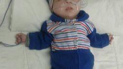 Un pequeño sanjuanino salió bien de una complicadísima operación