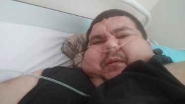 La dura historia del sanjuanino que pesaba más de 300 kilos y se salvó gracias a una cirugía inédita en el Rawson