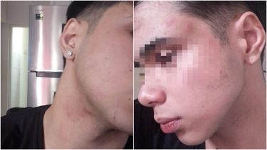 Grave denuncia de un locutor sanjuanino: contó los golpes que recibió su hijo en su boliche