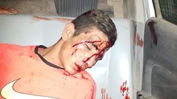 Justicia por mano propia, ¿sí o no?: mirá que opinan los sanjuaninos