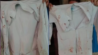 Tiene 7 años, le pegaron y así quedó su guardapolvo: en la escuela le dicen que se defienda solo