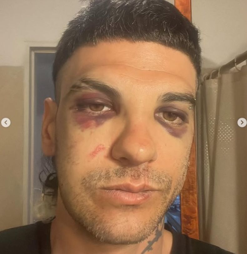 Así quedó el empresario tras la brutal golpiza Así quedó el empresario tras la brutal golpiza