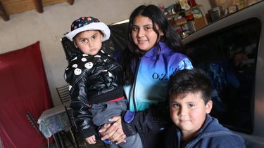 Por primera vez en su casa, el niño atacado por un pitbull en Caucete se recupera pero teme salir