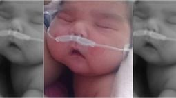 Maicol, el bebé de 9 de Julio que nació pesando 6 kilos está en terapia intensiva