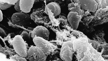 La peste bubónica es una enfermedad muy antigua.