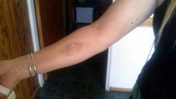 Denunciaron a un funcionario del municipio de Iglesia por agresión física