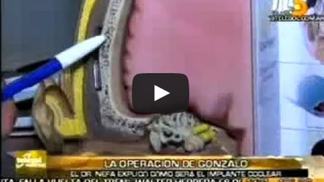 Cómo será la operación para que Gonzalito pueda escuchar