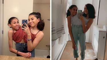 Una de las siamesas influencers está de novia y explicó el acuerdo entre ambas para tener intimidad con su pareja