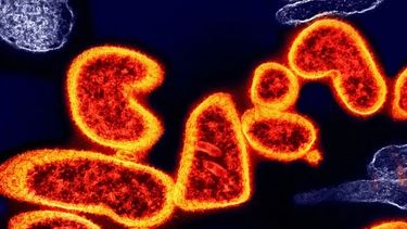 La India está atento ante un posible brote de Nipah.