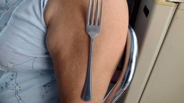 Qué dice una experta sanjuanina sobre el viral del brazo imantado tras recibir la vacuna del COVID