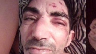 ¿Otro caso de maltrato en el hospital mental de Zonda?