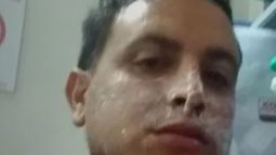 Desde el SEC explicaron cómo fue el accidente en el que dos trabajadores terminaron quemados