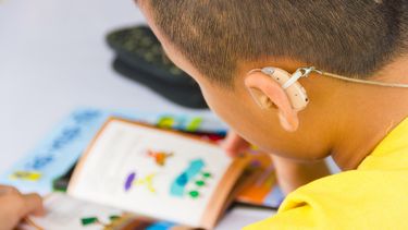 Tiene 7 años, necesita audífonos de $1.000.000 y hacen una rifa para ayudarlo