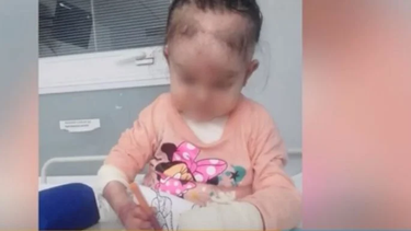 Una buena noticia para una sanjuanina con piel de cristal