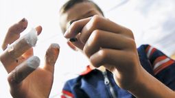 Un adulto y un menor con quemaduras leves por pirotecnia, el saldo de esta Nochebuena