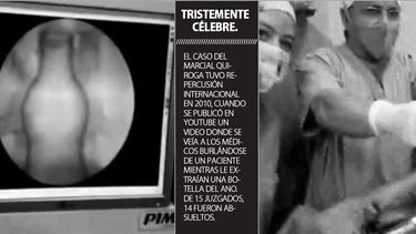 Emergencias bizarras: Los cuerpos extraños en el ano son habituales